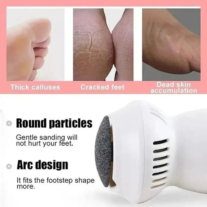 BowLift | Electric Foot File for Hard Skin Removal