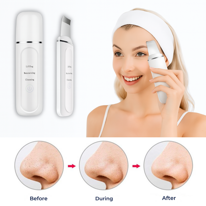 GlowSonic | Ultrasonic Facial Wand – Deep Cleansing – 33,000 Vibrations – At-Home Skincare Tool Bowlift