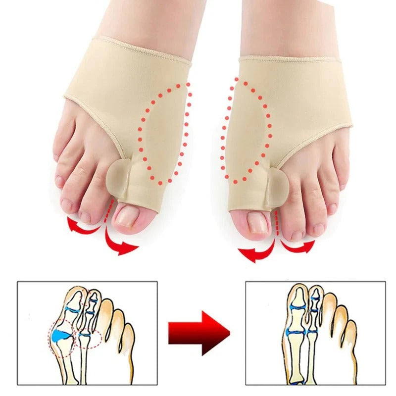 BowLift | Toe Separator with Alignment Support