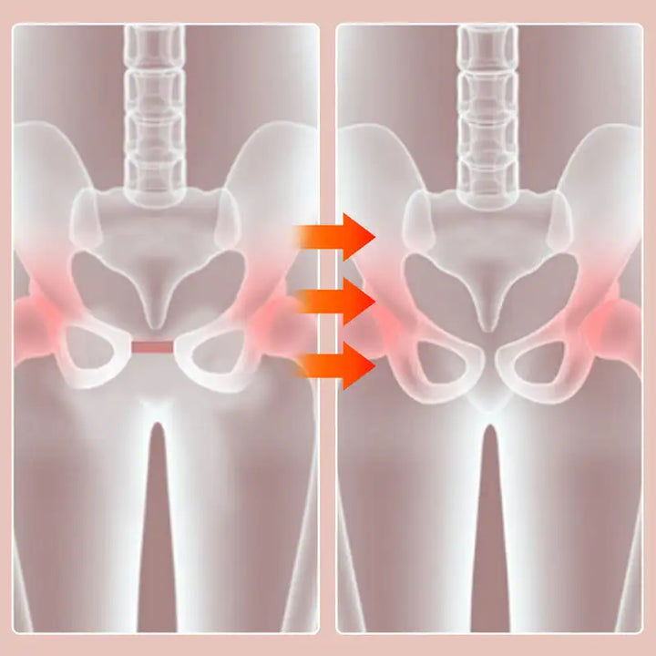 BowLift | Smart Pelvic Trainer
