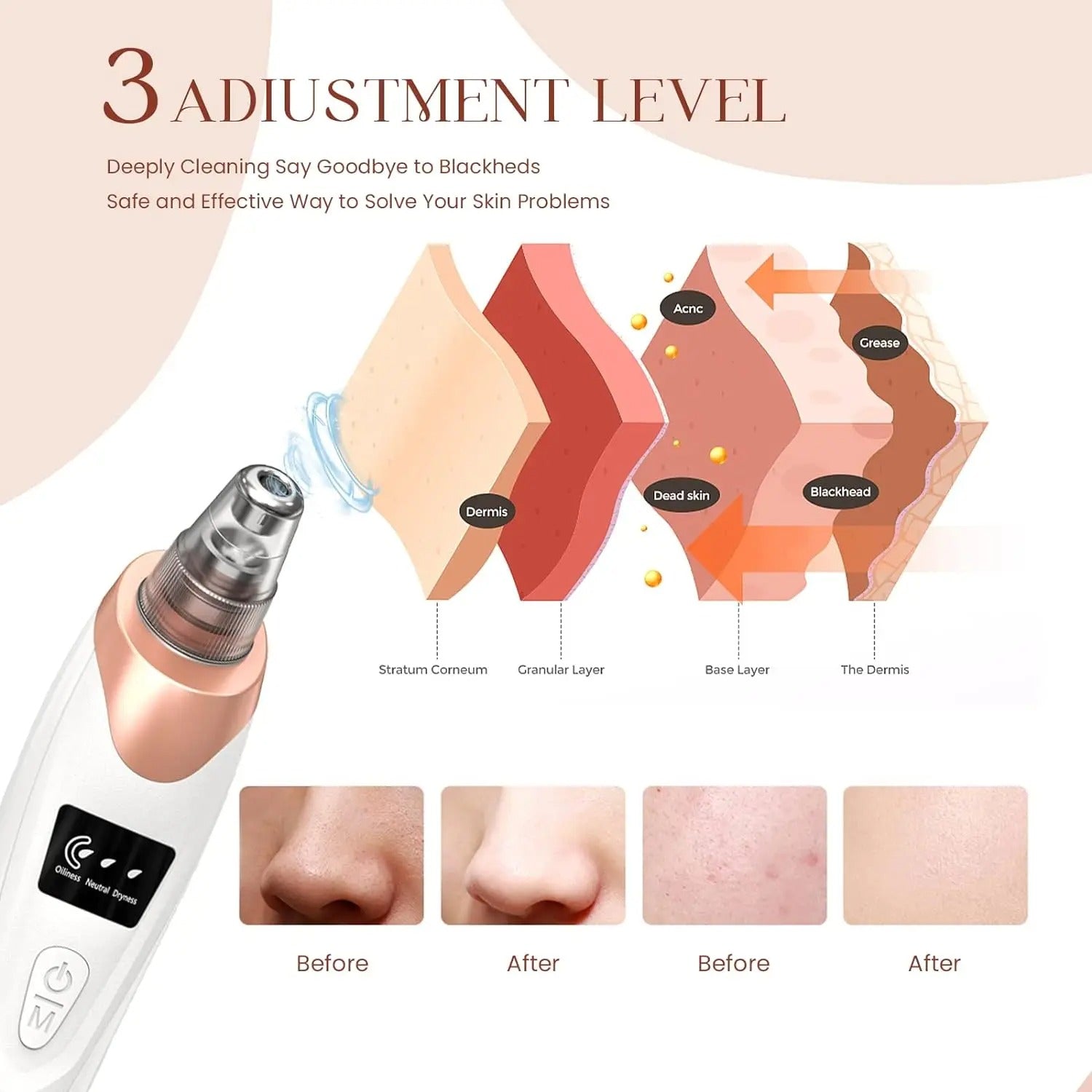 BowLift | Blackhead Remover Vacuum Pore Cleaner | Adjustable Suction, Multi-Functional Tool for Deep Cleansing & Acne Treatment at Home