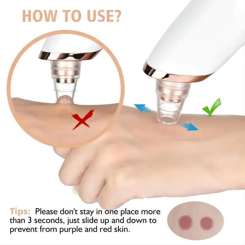 BowLift | Blackhead Remover Vacuum Pore Cleaner | Adjustable Suction, Multi-Functional Tool for Deep Cleansing & Acne Treatment at Home
