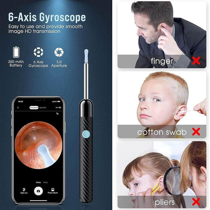 BowLift | Ear Wax Removal Tool | 1080P HD Camera, LED Lights & Adjustable Scoops for Safe Ear Hygiene at Home