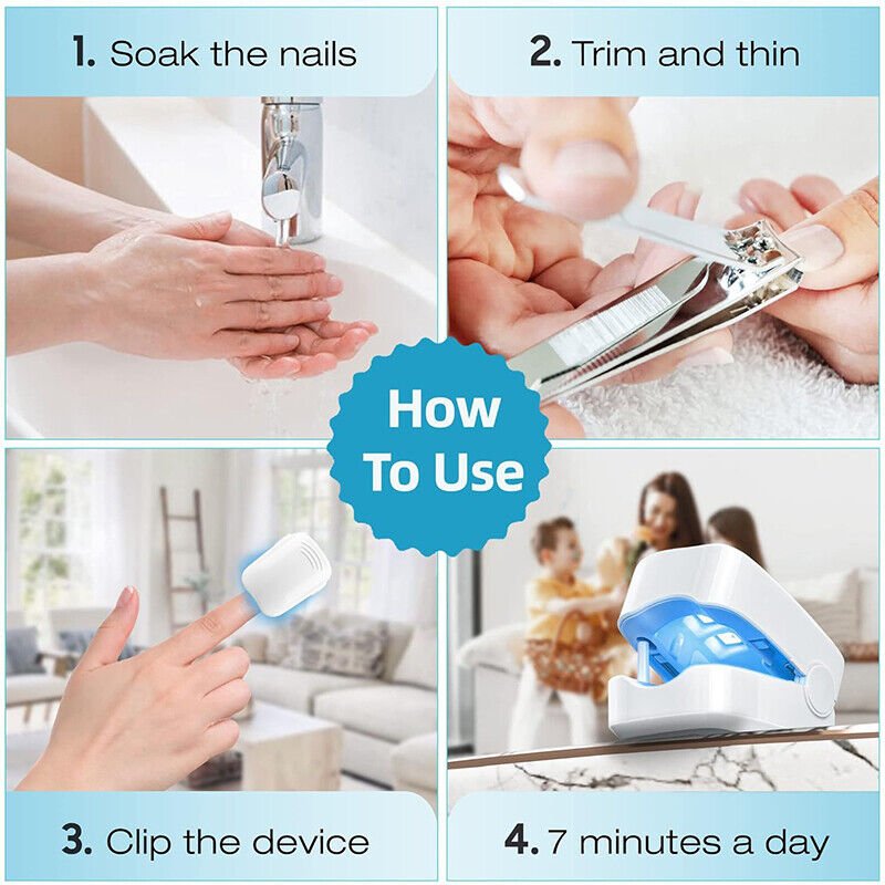 BowLift | Laser device for nail fungus cleaning – Revolutionary, highly efficient light therapy device from Expert for toe nail conditions