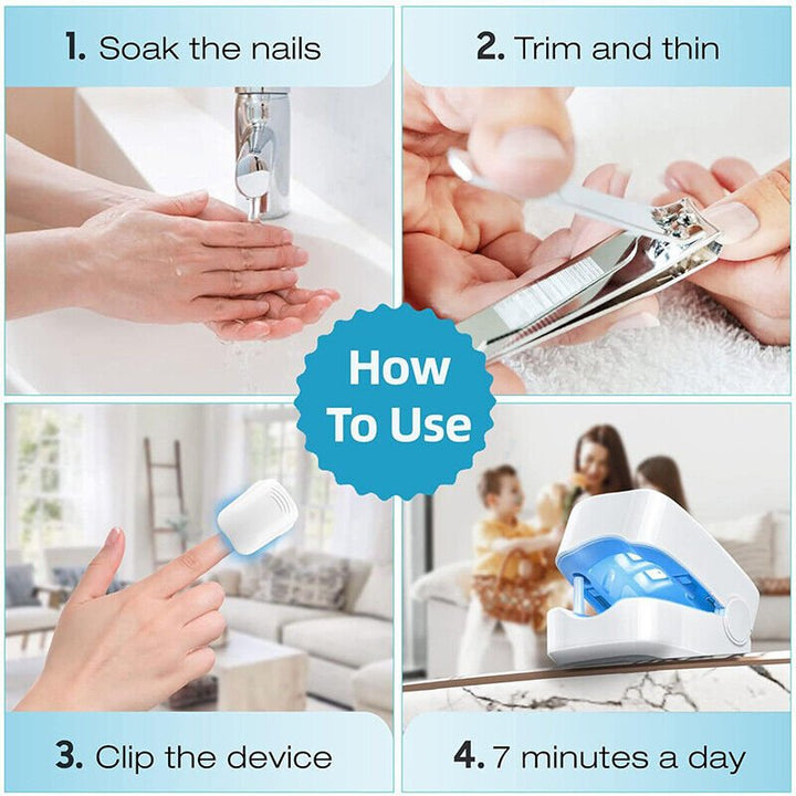 BowLift | Laser device for nail fungus cleaning – Revolutionary, highly efficient light therapy device from Expert for toe nail conditions