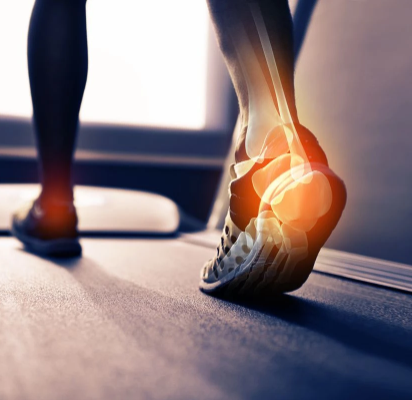 BowLift | FootFlex Comfort Band – Supportive Foot Band against Heel Pain