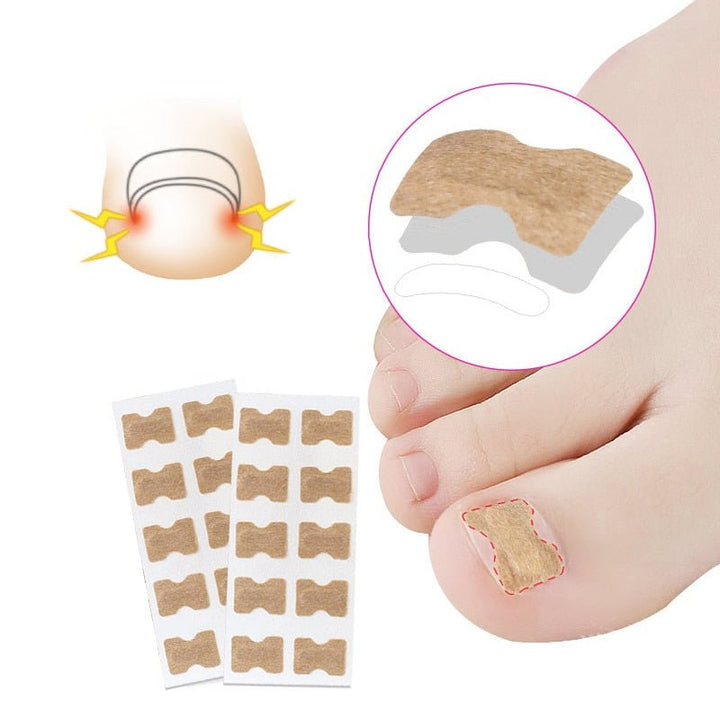 BowLift | Painless Toenail Patch - ToenailExpress™