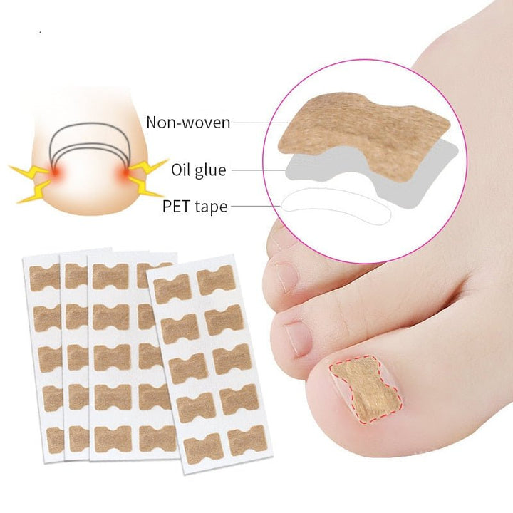 BowLift | Painless Toenail Patch - ToenailExpress™