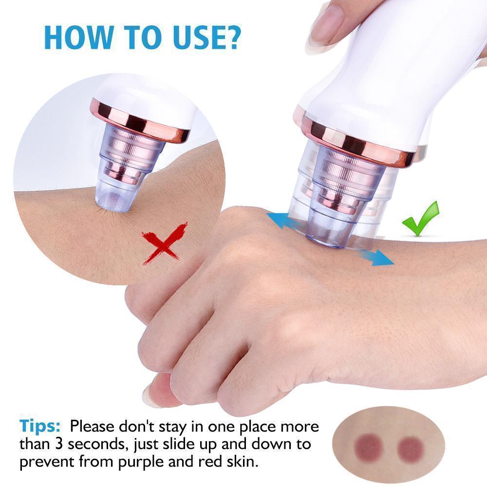 BowLift | Power Suction Blackhead Cleaner
