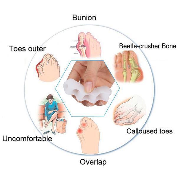 BowLift | Orthopedic Toe Corrector - Toe Separator