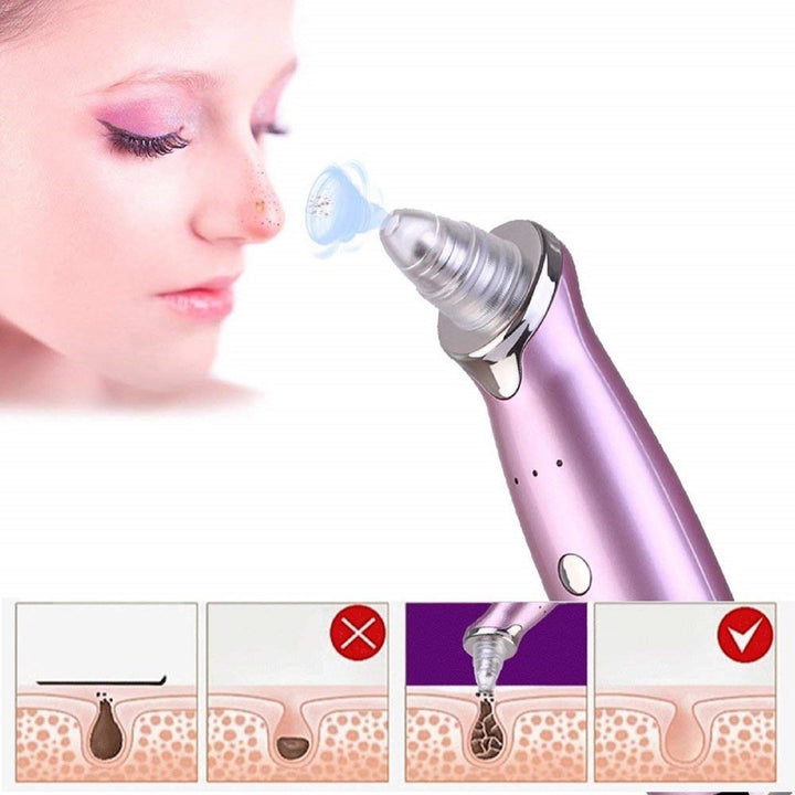 BowLift | Electric Facial Pore Cleaning Tool Acne/Blackhead Remover