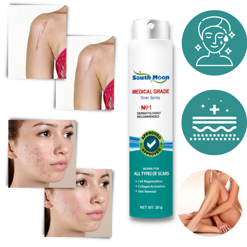 Spray treatment for scar removal