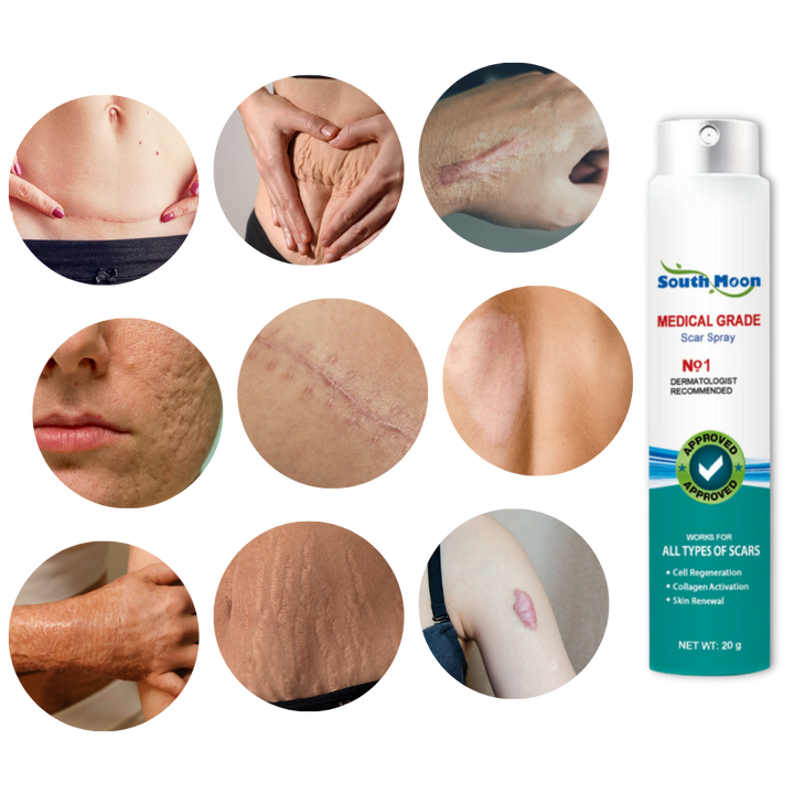 Spray treatment for scar removal