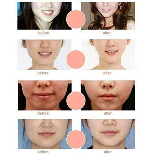 BowLift | V Line Chin Up Face Lift Mask