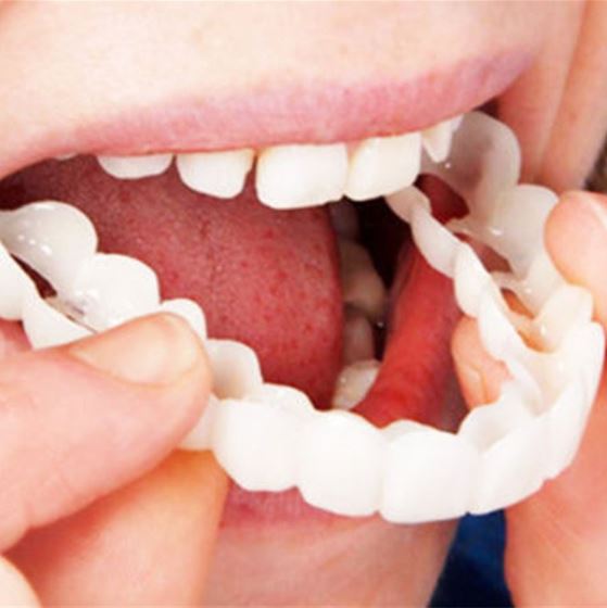 BowLift | Snap-on Teeth™ - With these veneers, always have the perfect smile